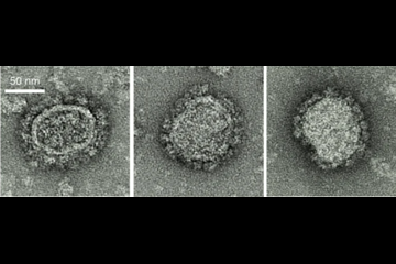 mRNA疗法再下一城：开发HIV疫苗 恒河猴感染风险降低79%